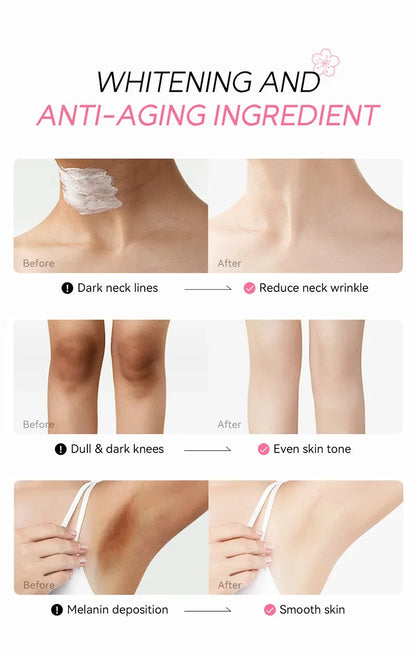 Laikou Sakura Underarm Cream Knee Buttocks Dark Skin  Improve Melanin Pigmentation Korean Skin Care Product 30g