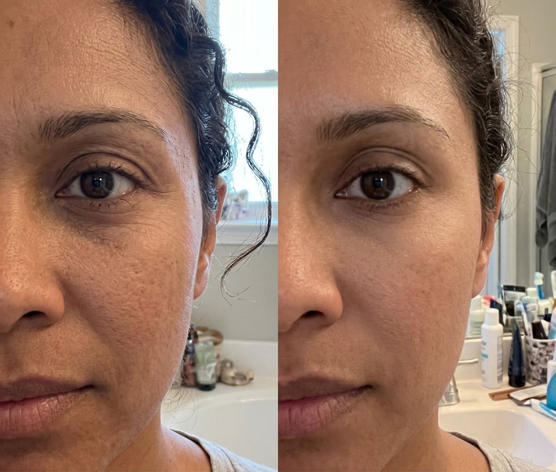 Caroline, 42